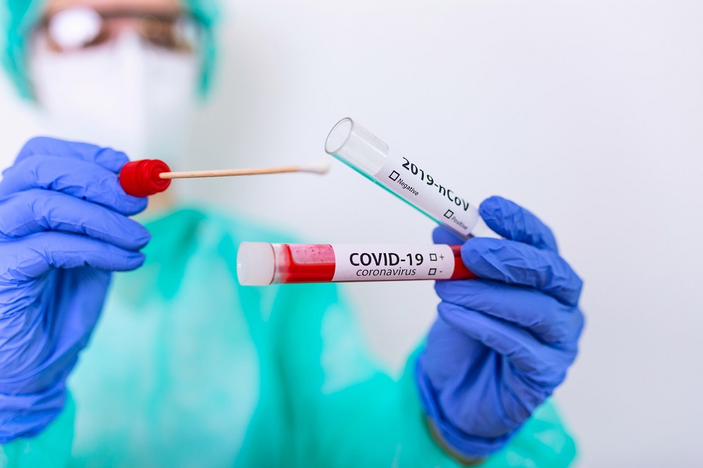 TAMPONE-CORONAVIRUS-COVID