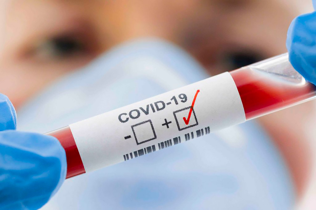 test-sangue-covid-19
